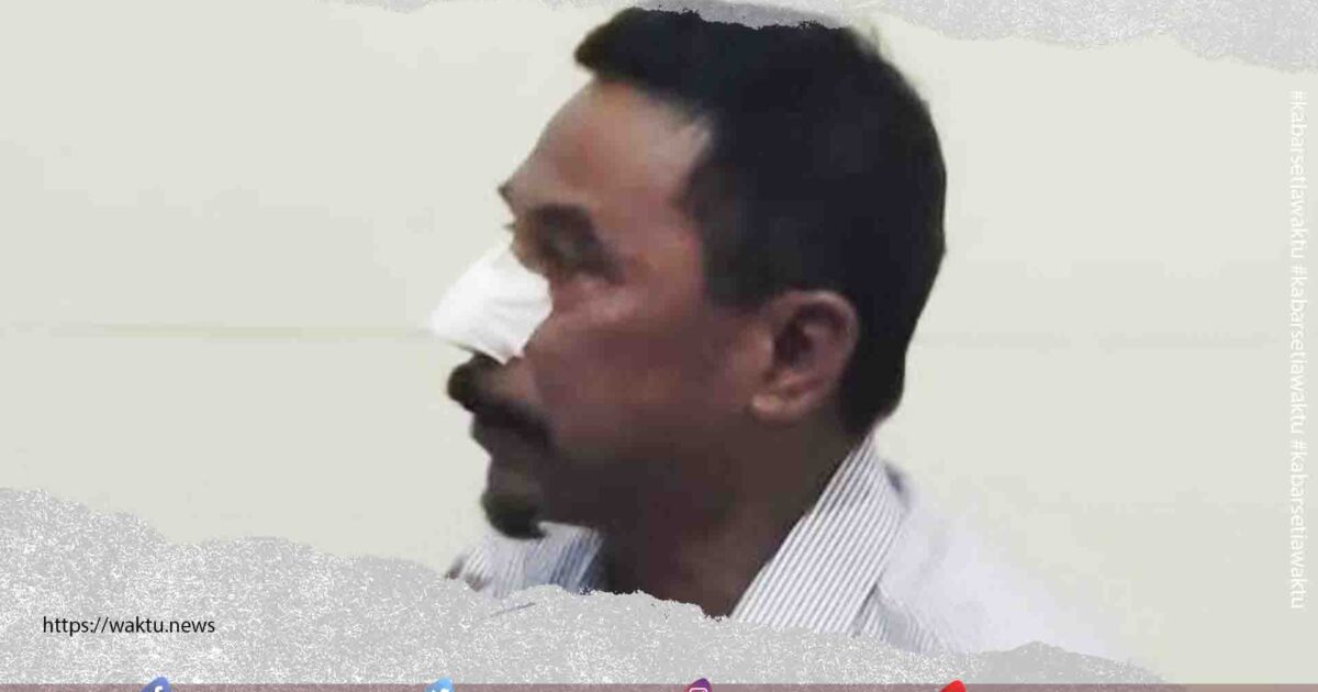 Hidung Mantan Bupati Boltim