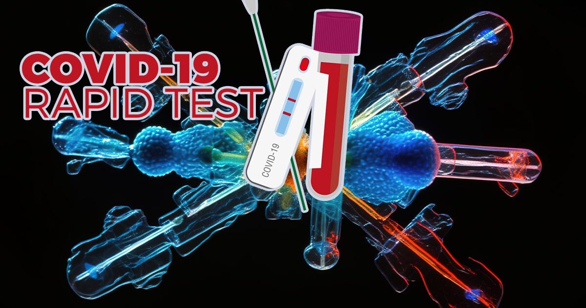 Dinkes Bolmong Gelar Rapid Test Covid-19