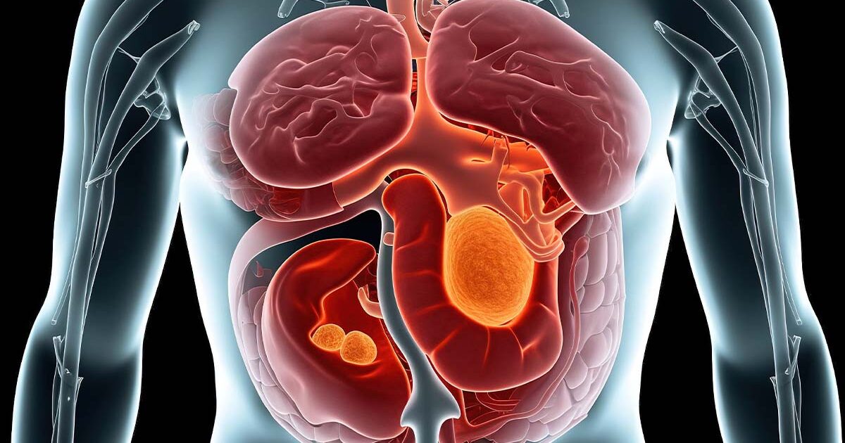 Suplemen yang Bisa Rusak Ginjal