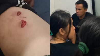 Pria Diserang Buaya Saat Mandi