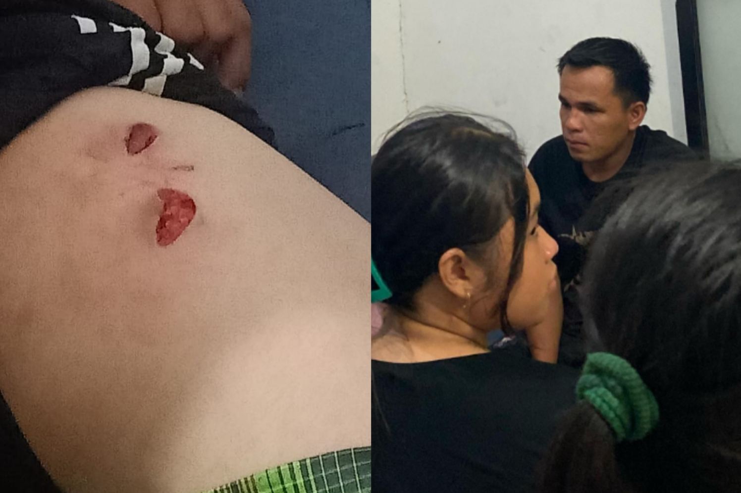 Pria Diserang Buaya Saat Mandi